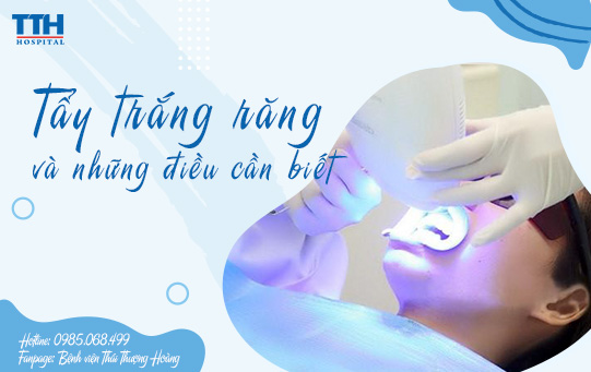 Tẩy trắng răng và những điều cần biết
